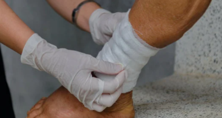 Doctor Bending on the leg at Angeles Wound Care Institute in Bend, Oregon